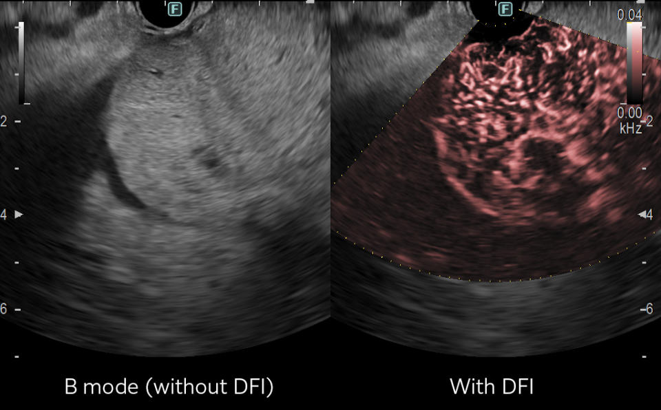 Ultrasound image comparison