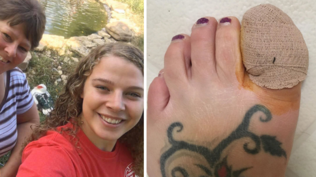 US mum rushed to urgent care after pedicure leads to nasty toe infection