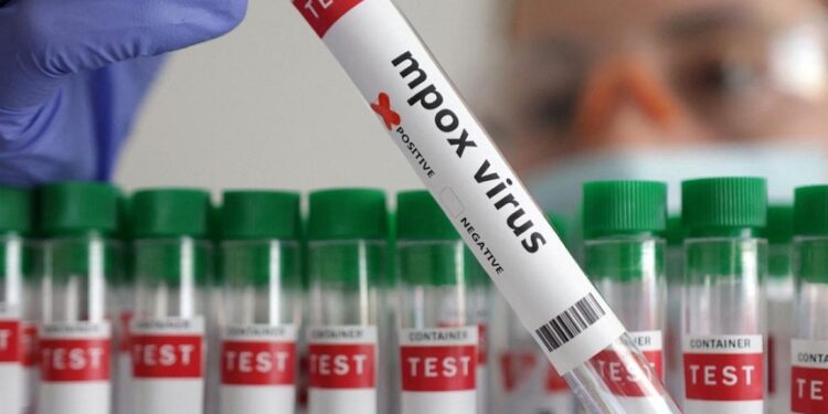 Germany identifies its first case of new mpox variant, Bild reports