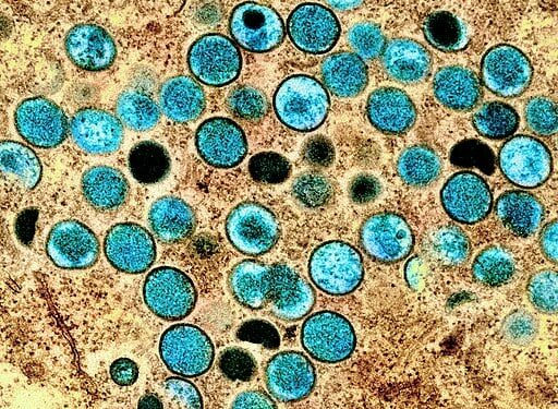 Mpox or monkeypox: what you need to know