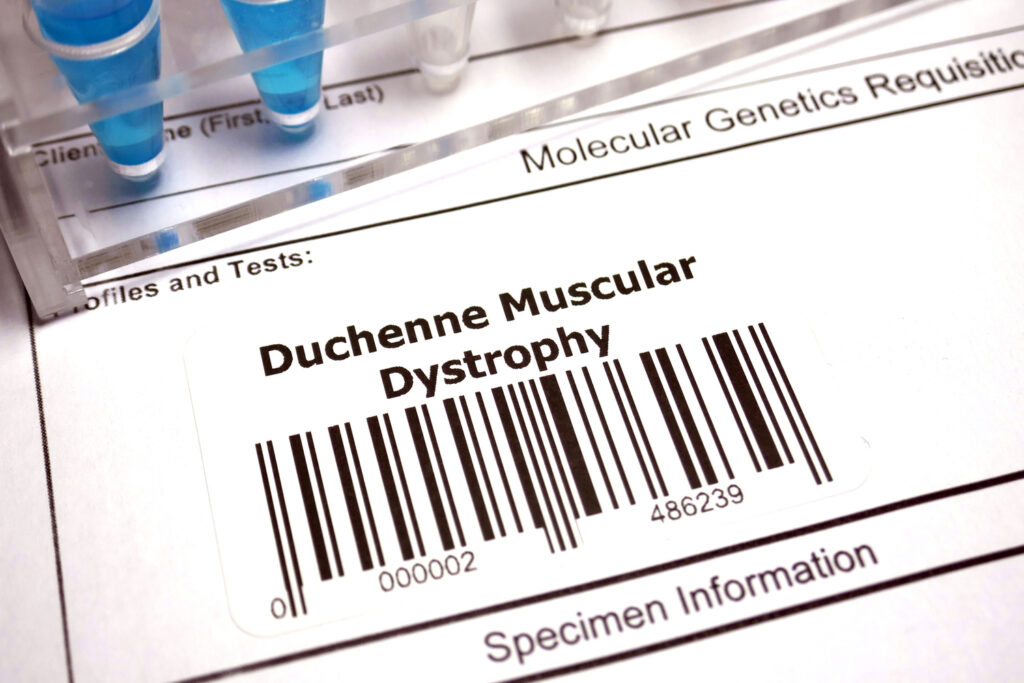 PTC Therapeutics DMD drug misses regulatory hurdle