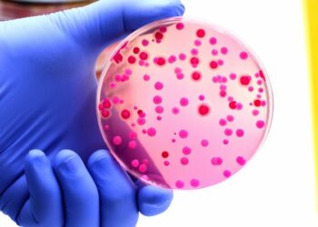 Antibiotics business model should be the flipside of pharma norm, says Shionogi Europe CEO – Euractiv Antibiotics business model should be the flipside of pharma norm, says Shionogi Europe CEO – Euractiv