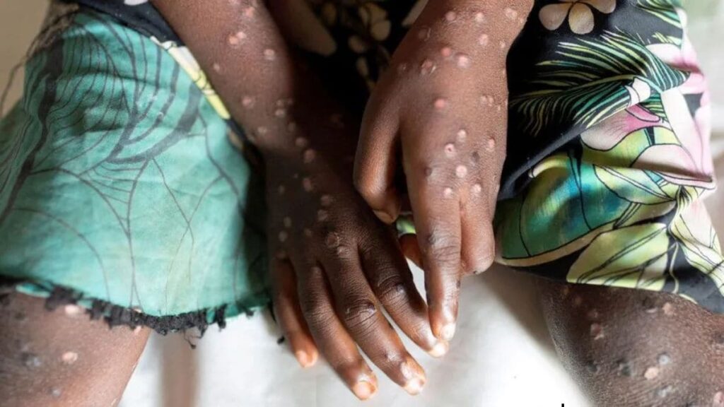 Belgium 8th non-African nation to report new variant, WHO says situation ‘especially concerning’ – Firstpost