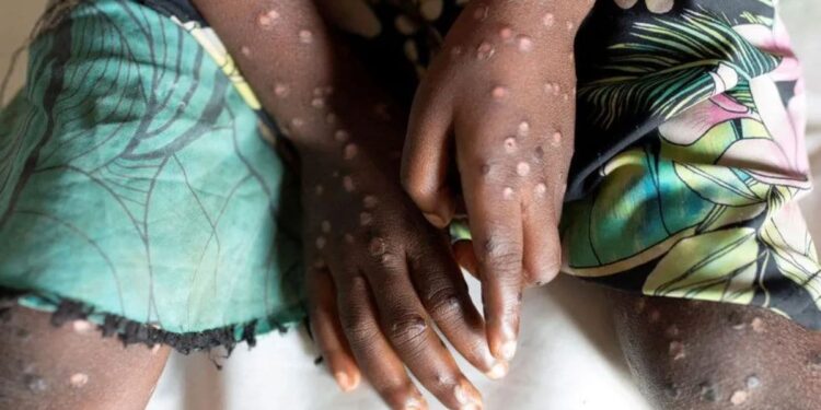 Belgium 8th non-African nation to report new variant, WHO says situation ‘especially concerning’ – Firstpost
