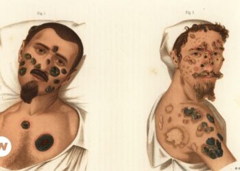 Did Columbus bring the STD to Europe? – DW – 12/18/2024